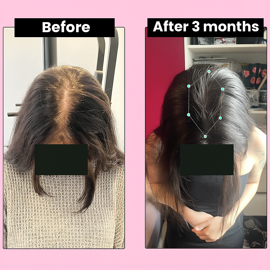 Florelle Extreme Regrowth